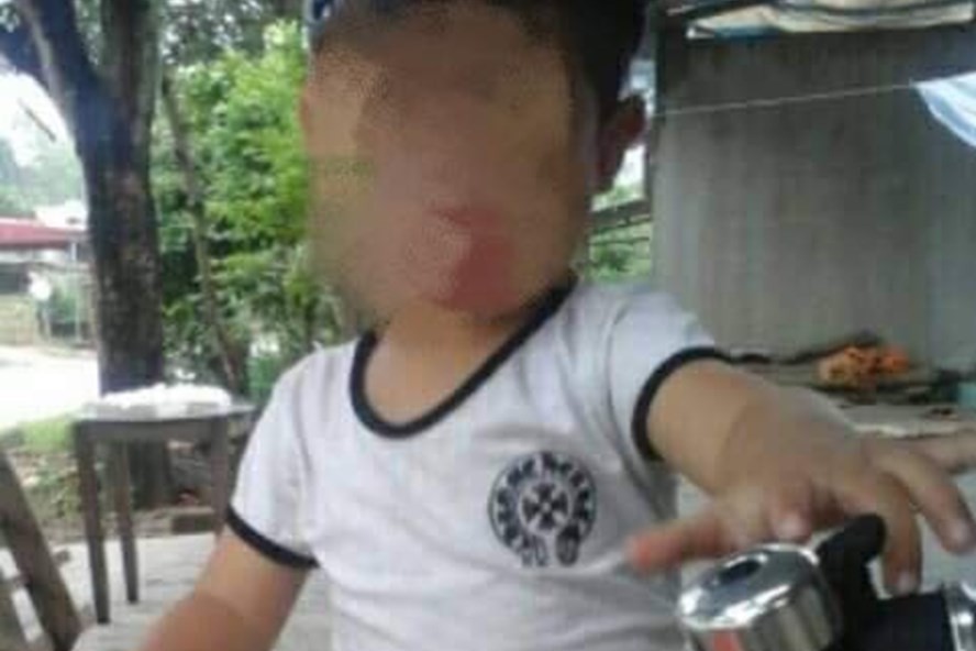 Bé trai 5 tuổi ở Yên Bái tử vong bất thường sau khi gây mê cắt amidan