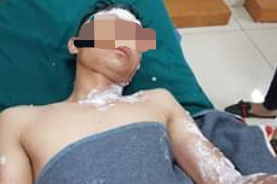 Quảng Bình: Nhiều người nhập viện cấp cứu do đốt pháo trái phép
