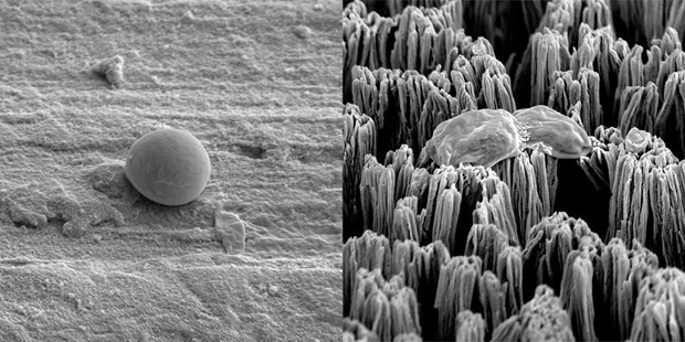 Một tế bào Candida nguyên vẹn trên bề mặt titan đánh bóng (trái) và một tế bào Candida bị vỡ trên bề mặt titan có gai siêu nhỏ (phải). Nguồn: RMIT.