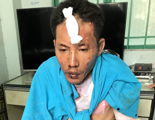Ông Nguyễn Quang Dũng đang bị cơ quan Công an tạm giữ.