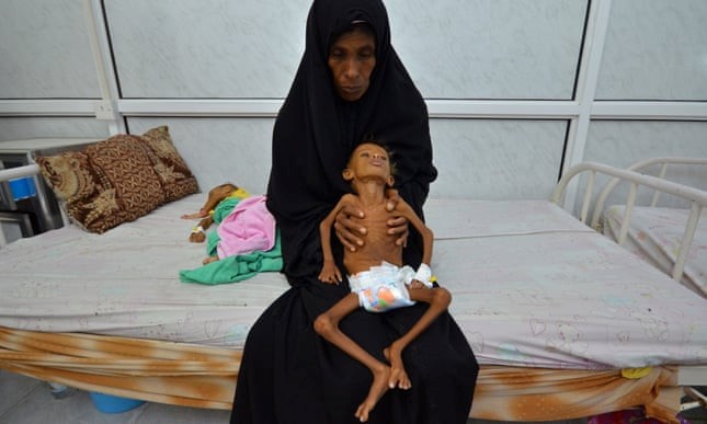 Một bà mẹ và con trai 6 tuổi người Yemen trong một bệnh viện tại thành phố cảng Hodeida. Ảnh: Reuters