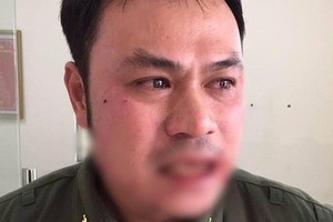 Tạm giữ người phụ nữ 'cò mồi' đánh nhân viên an ninh sân bay Nội Bài gãy 4 răng cửa