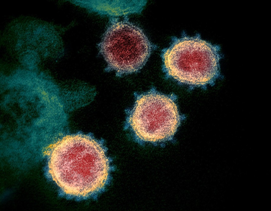 Covid-19, virus corona, SARS-CoV-2, nhà khoa học, nghiên cứu, phát hiện mới, virus SARS, tế bào