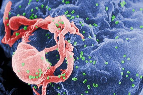 Italy và Nam Phi hợp tác nghiên cứu vắcxin điều trị HIV/AIDS