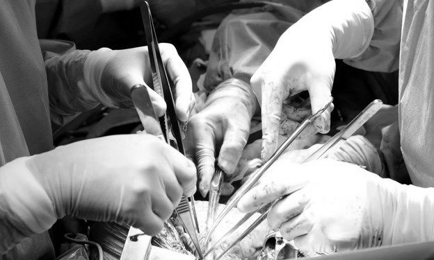 Bác sỹ làm phẫu thuật cho nam thanh niên bị dao đâm thủng tim, ảnh minh họa