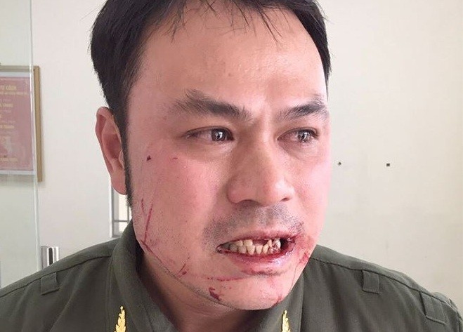Nhân viên an ninh sân bay Nội Bài bị cò mồi taxi đánh gãy 4 răng