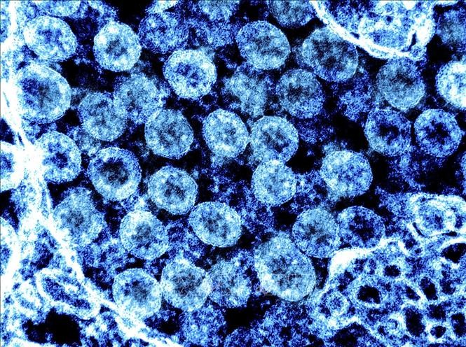 Hình ảnh từ kính hiển vi do Viện nghiên cứu bệnh truyền nhiễm và dị ứng quốc gia Mỹ cung cấp cho thấy virus SARS-CoV-2 trong mẫu bệnh phẩm của bệnh nhân mắc COVID-19. Ảnh minh họa: AFP/TTXVN