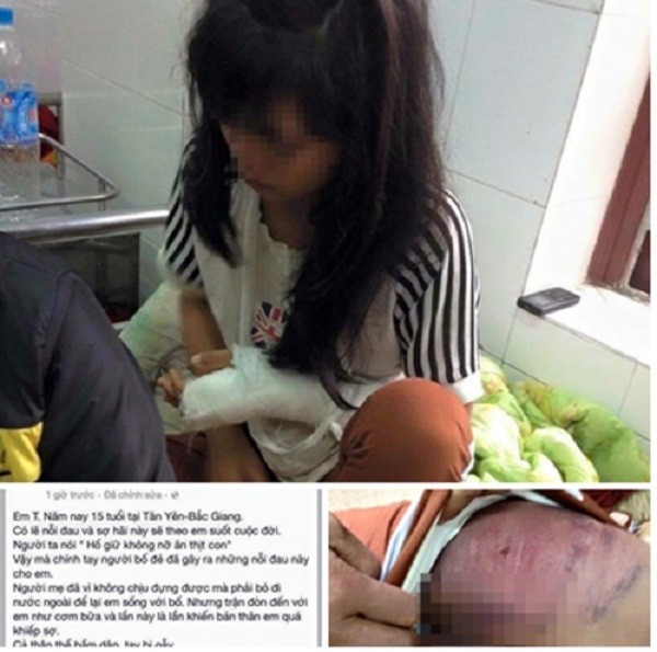 Bé gái ở Bắc Giang bị bố đánh vì quay clip đánh nhau