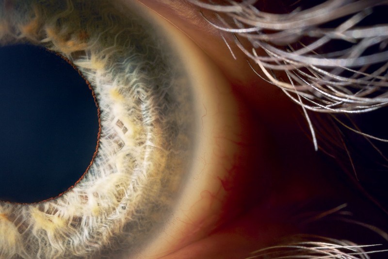 Mắt bionic – cơ hội mới cho những người mù do bị chấn thương 