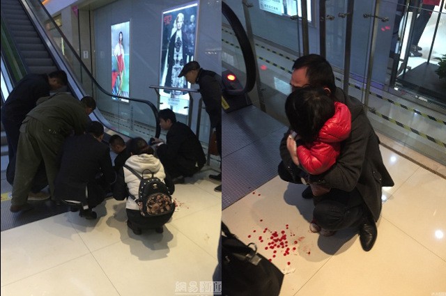 Trung Quốc: Bé gái 2 tuổi bị thang cuốn nghiến đứt ngón tay