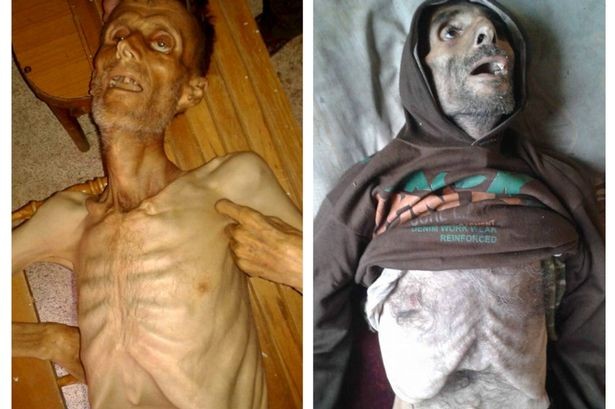Nạn đói biến người dân Syria thành “những bộ xương khô”