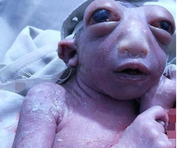 Hoảng hồn 'em bé ngoài hành tinh' sinh ra tại Ấn Độ
