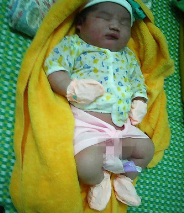 Bé trai sơ sinh có cân nặng 'khủng' 5,1kg ở Quảng Nam