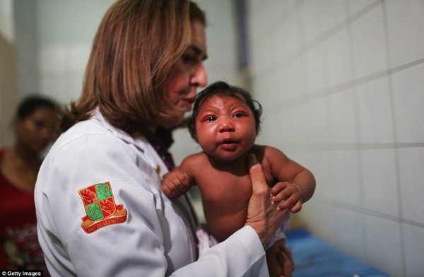 Những bức ảnh khiến bạn ám ảnh về dịch bệnh 'Zika đầu nhỏ'