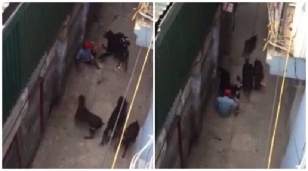 4 con chó tấn công 'chủ nhân': Cánh tay người đàn ông bị cắn nát