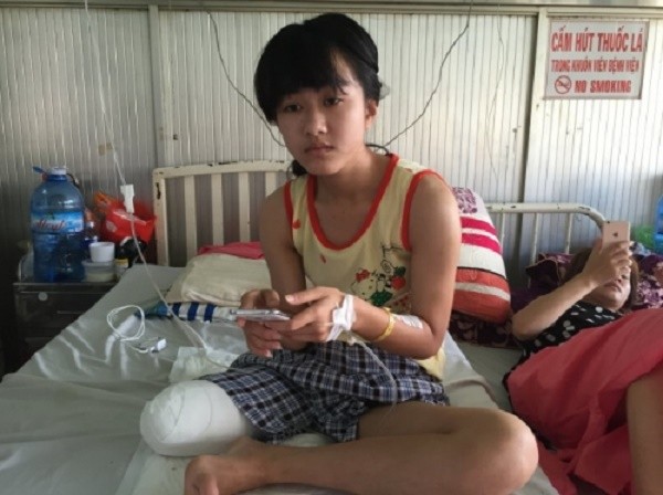 Vụ nữ sinh bị mất chân 'oan': Trường hợp bị hoại tử chân rất ít