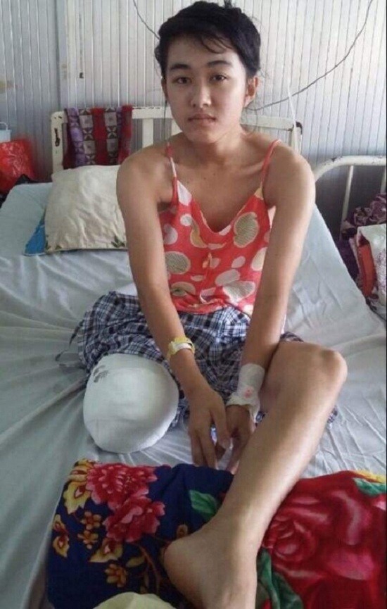 Sở Y tế Đắk Lắk xin lỗi nữ sinh lớp 10 bị cưa chân 'oan'