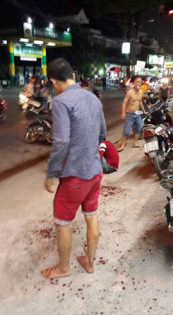 Nhận diện côn đồ truy sát chém lìa tay thanh niên giữa Sài Gòn
