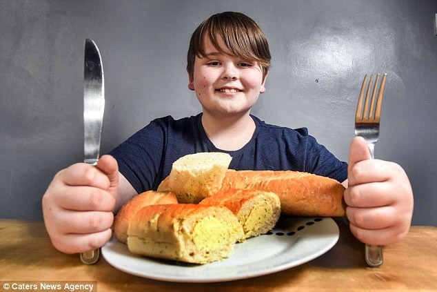 Cậu bé chỉ ăn bánh mì tỏi suốt 8 năm sau khi chữa khỏi ung thư