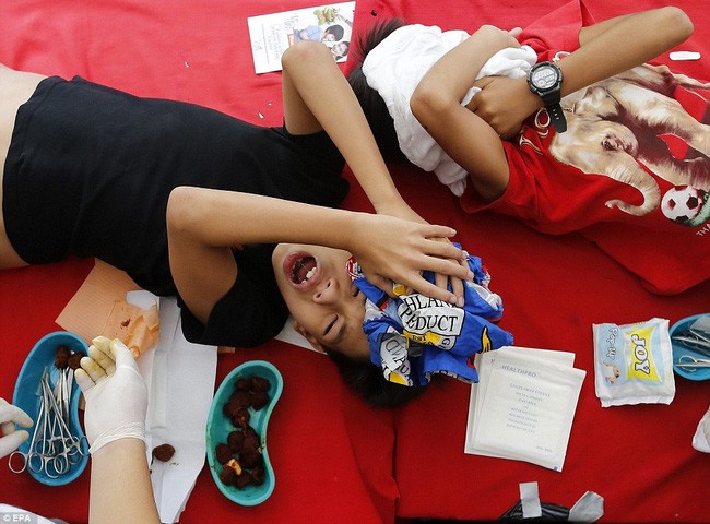 300 trẻ em đau đớn trong lễ cắt bao quy đầu ở Philippines
