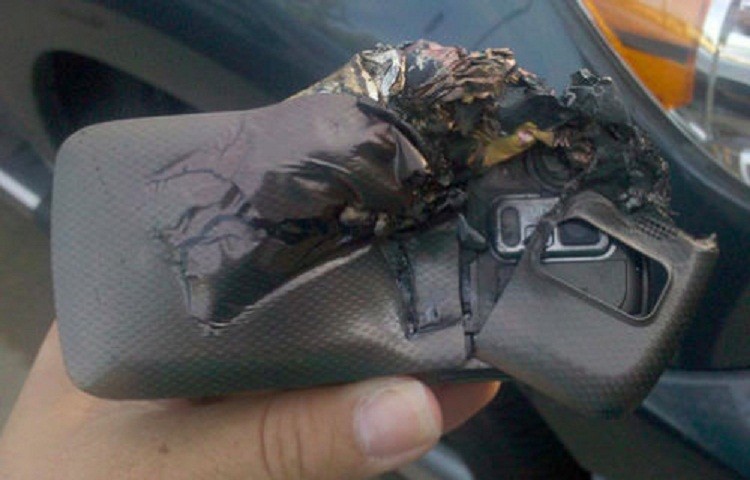 Bị bỏng nặng vì điện thoại di động phát nổ trong túi quần