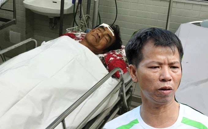 Sau ông Nén, ông Nguyễn Thanh Chấn bị tai nạn xe máy
