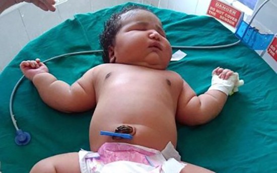 Bé gái sơ sinh nặng nhất thế giới chào đời ở Ấn Độ